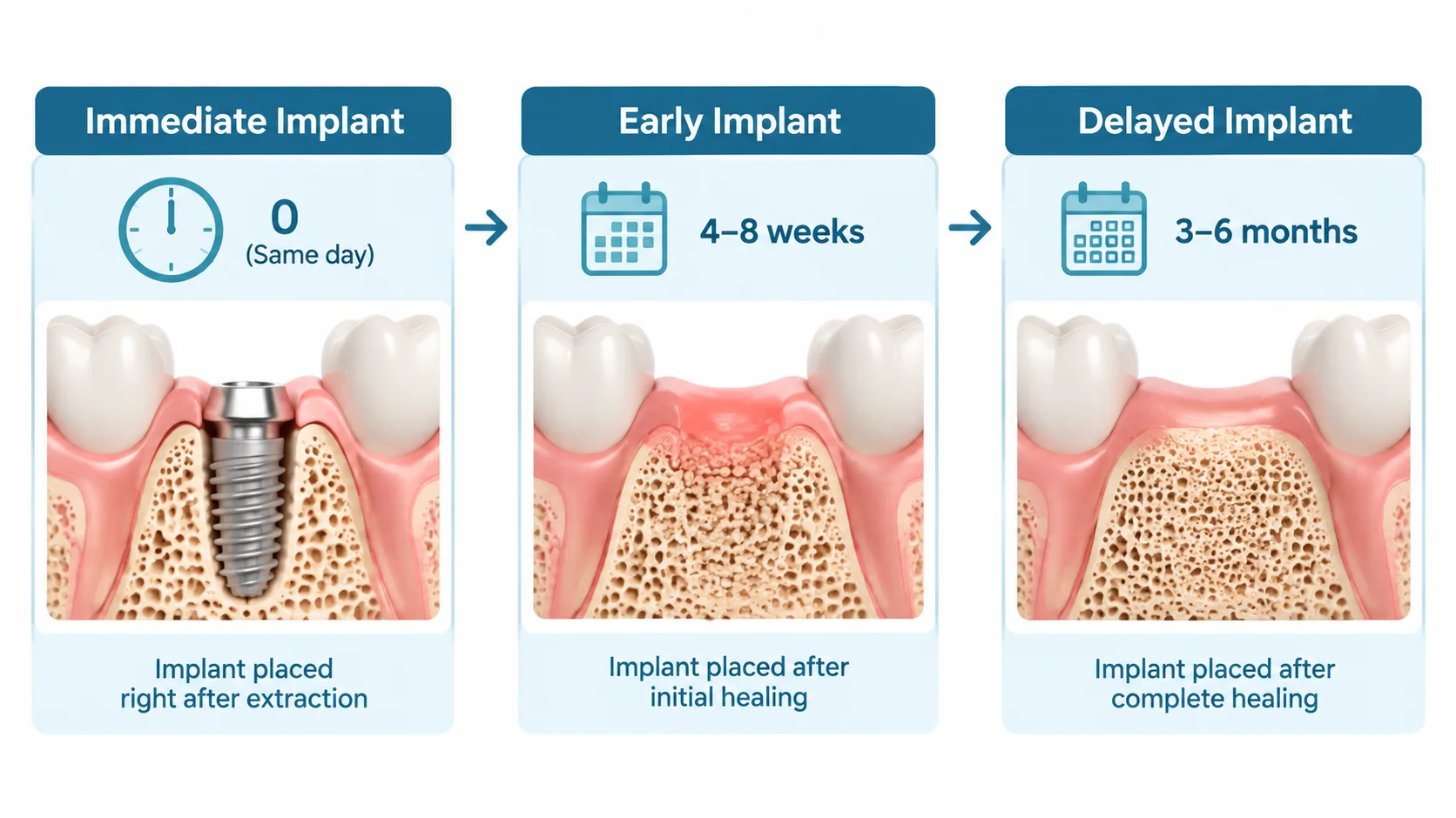 Hemen, erken ve geç implant zamanlaması akış şeması